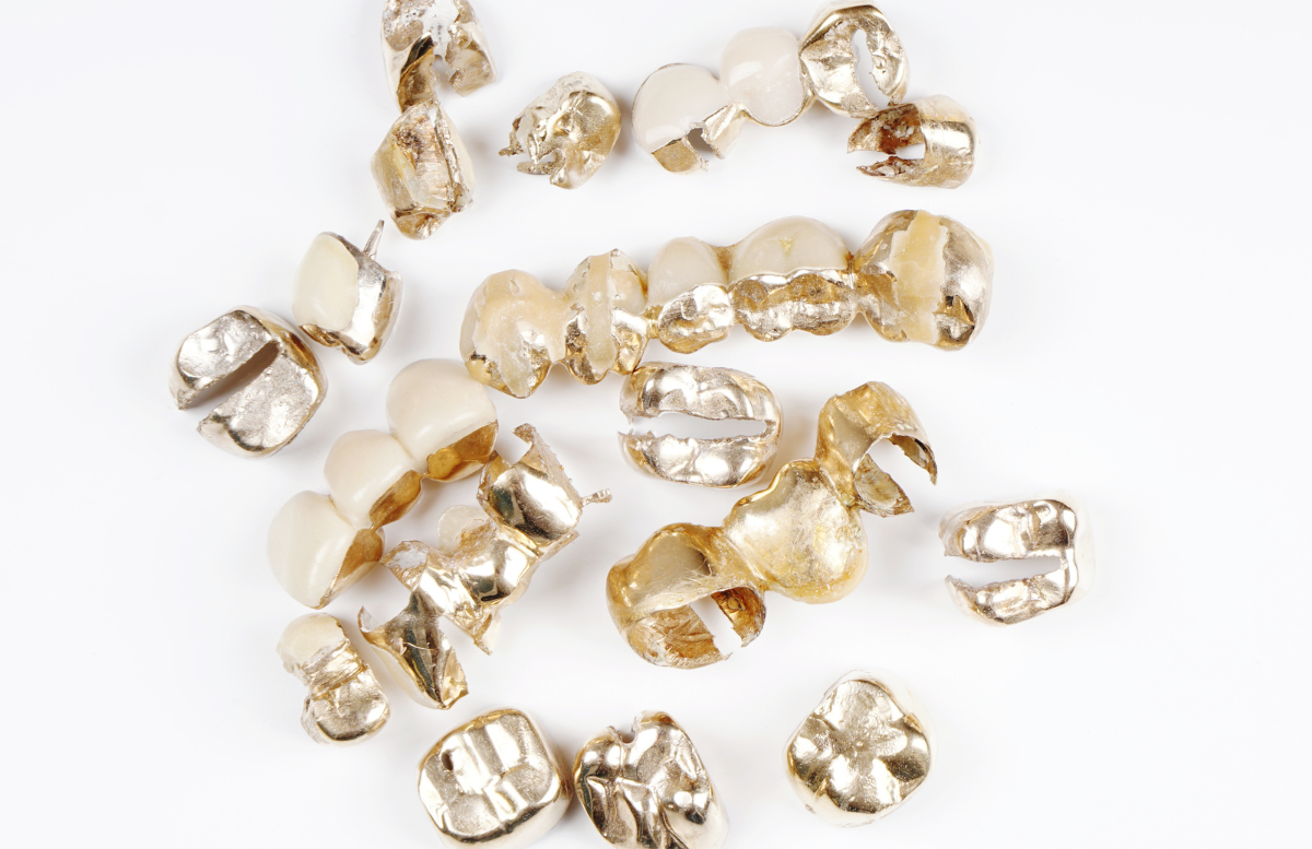 Reusing Gold from Dental Scrap